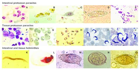  Cryptosporidium: Un Parassita Microscopico Che Infetta il tuo Intestino con un Sorriso Insidioso!