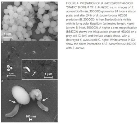  Vampyrellidae: Un mistero motile con tentacoli voraci e un appetito insaziabile per batteri!